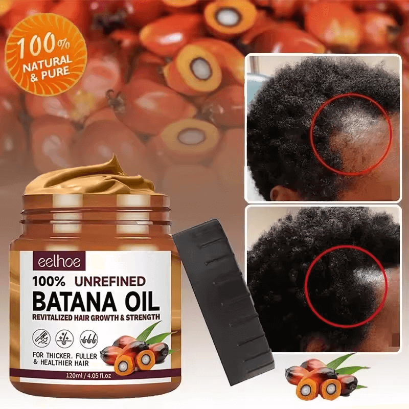 Batana Boost – Croissance & Force Capillaire