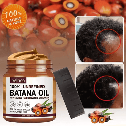 Batana Boost – Croissance & Force Capillaire
