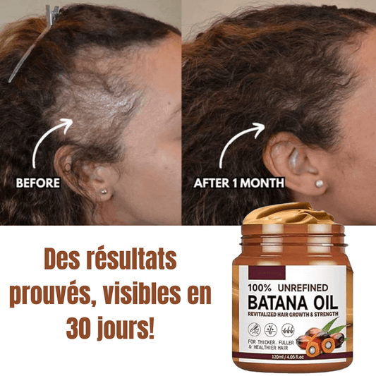 Batana Boost – Croissance & Force Capillaire