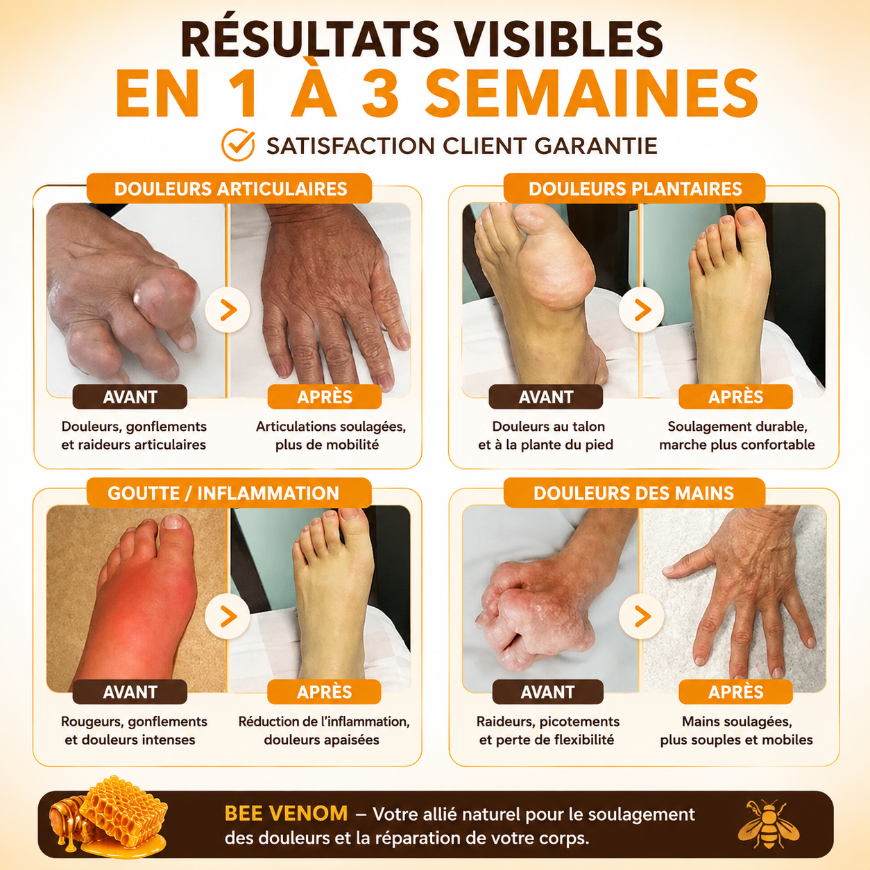 🐝 BEE Venom™ – La Crème au Venin d’Abeille qui Soulage les Douleurs Musculaires et Articulaires