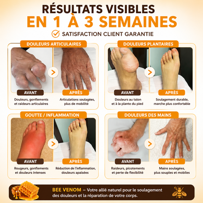 🐝 BEE Venom™ – La Crème au Venin d’Abeille qui Soulage les Douleurs Musculaires et Articulaires