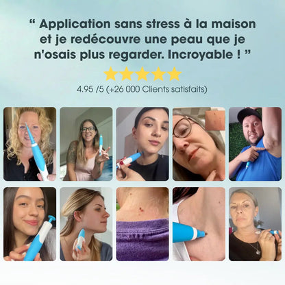 Éliminez ces excroissances en quelques jours, sans douleur